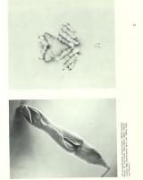 Citation block thumbnail